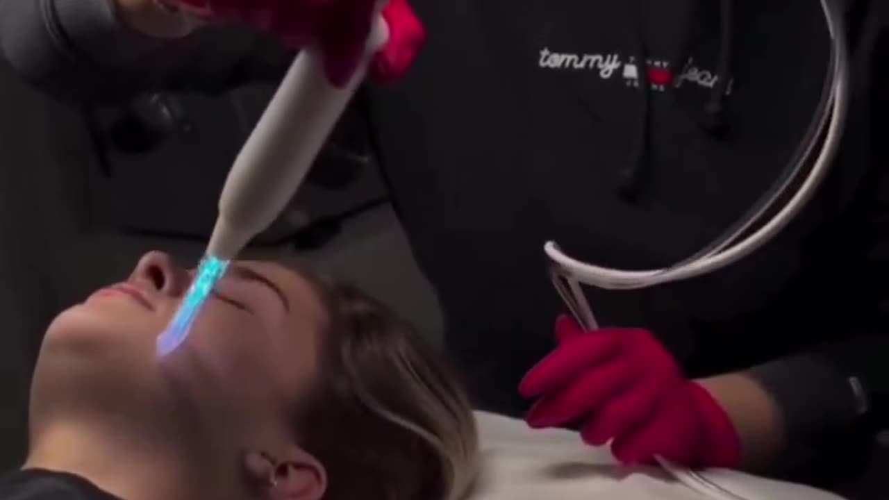 Cold atmospheric plasma (CAP) treatment speeds up the wound healing process and disrupts