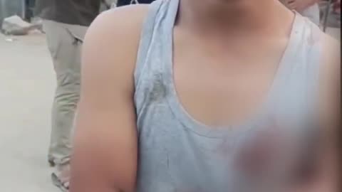 A Palestinian child was stabbed today while trying to secure a bag of flour