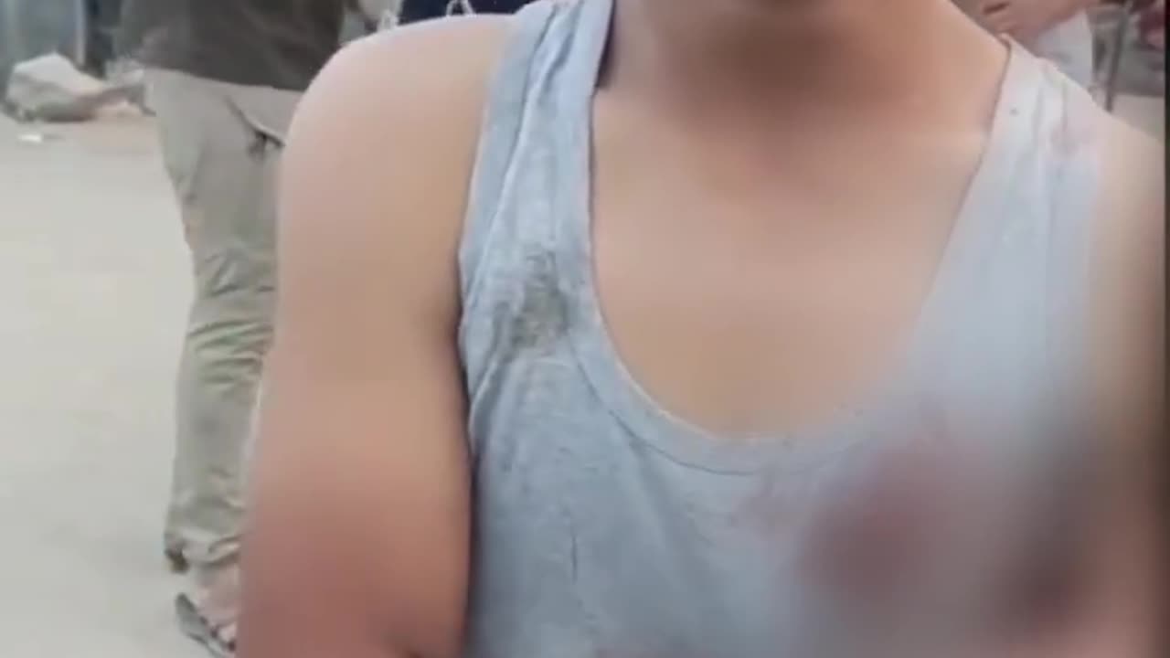 A Palestinian child was stabbed today while trying to secure a bag of flour