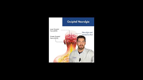 What is causing my occipital neuralgia? | occipital neuralgia relief | Neckwise