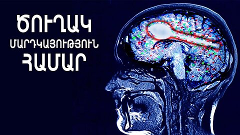 Ծուղակ մարդկության համար | Գիտական Հանրաճանաչ ​​Ֆիլմ
