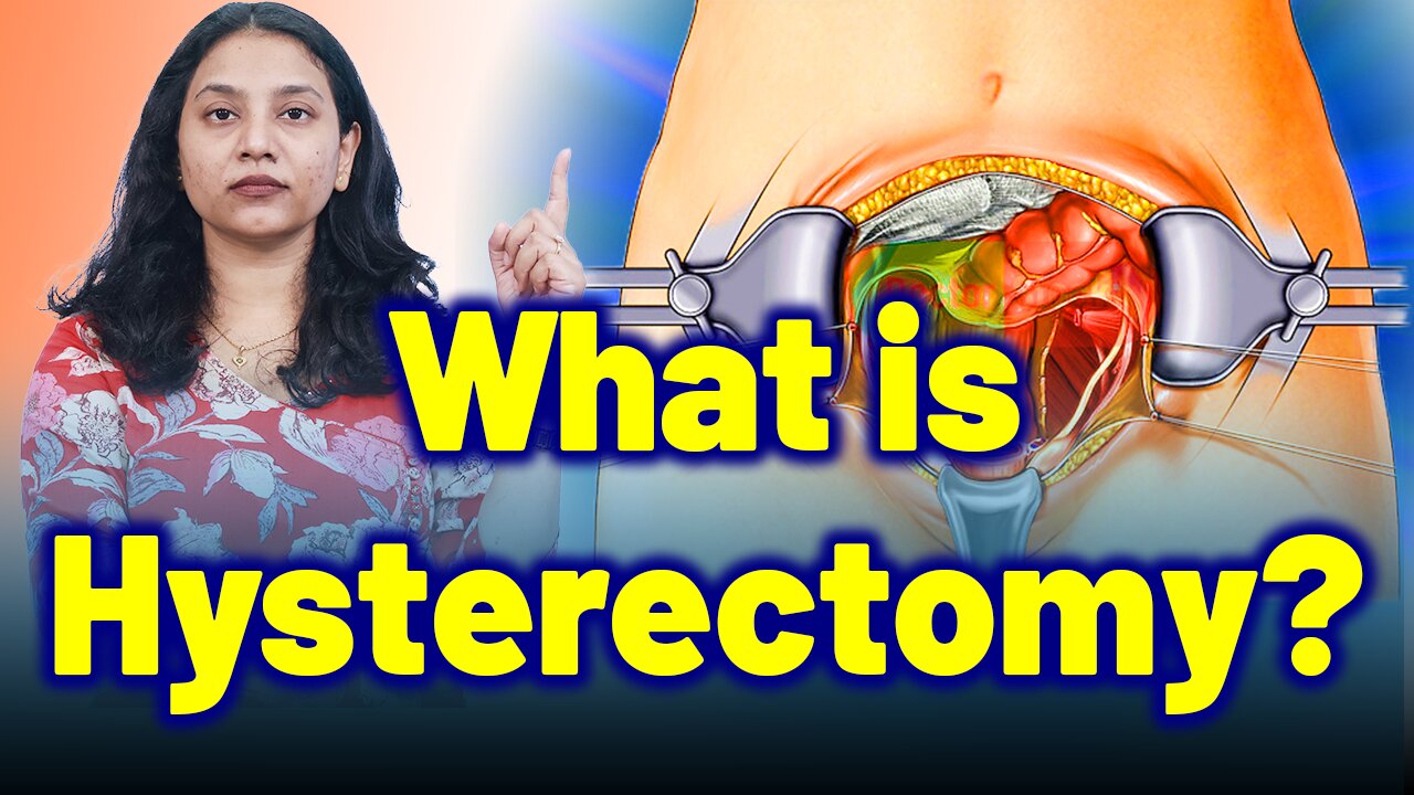 Hysterectomy: What Every Woman Should Know about Fibroids? | Treatment & Cure | Homeopathy, Medicine
