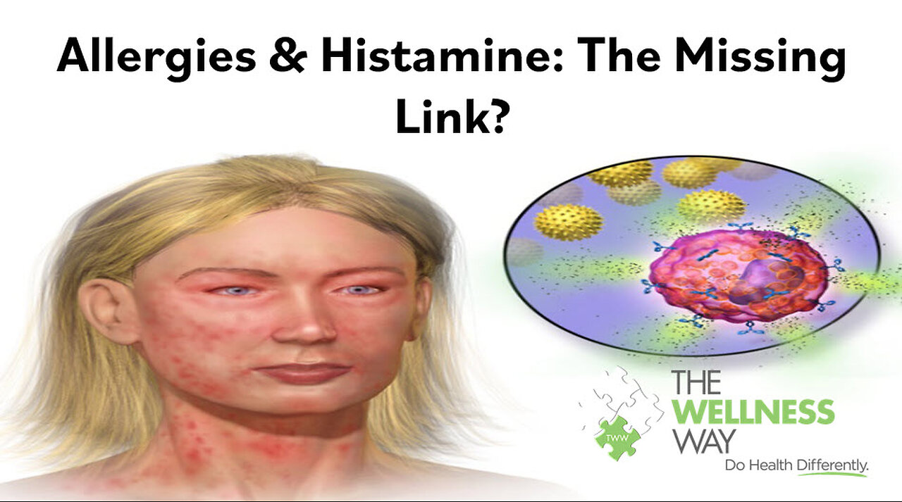 Allergies and Histamines: The Missing Link PART 1