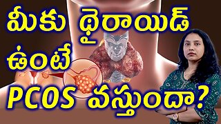 మీకు థైరాయిడ్ ఉంటే PCOS వస్తుందా? Does Hypothyroidism Causes PCOS Homeopathy Treatment Cure Medicine