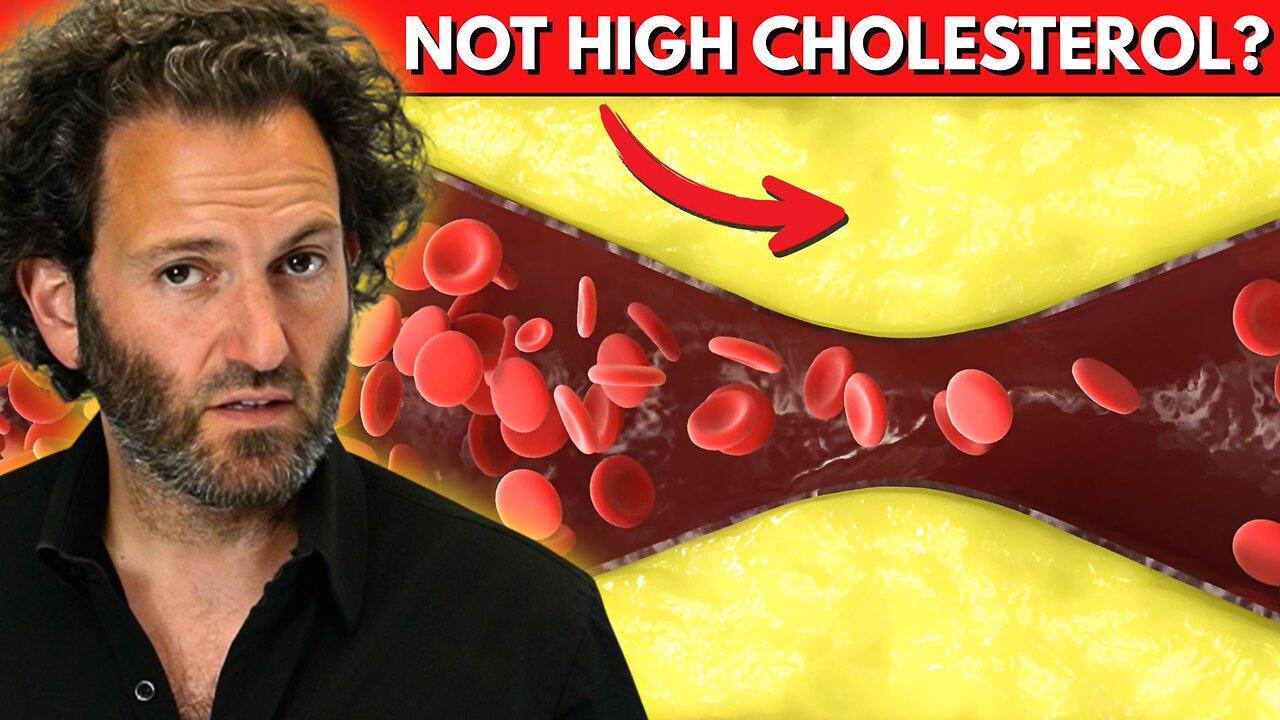 Does High Cholesterol REALLY Cause Heart Attacks?