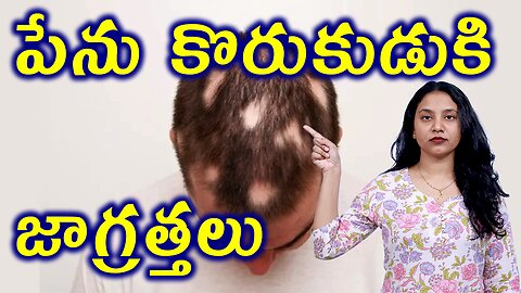 పేను కొరుకుడుకి జాగ్రత్తలు Precautions for Alopecia Areata or Spot Baldness Homeopathy Treatment