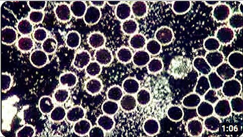 "Dark Field Examination Video Clip: Live Blood Analysis"