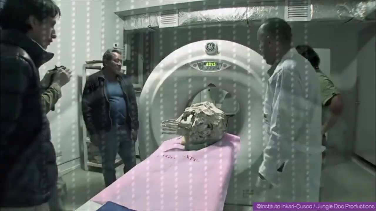 Project Unity - This Alien Looking Mummy Has A BABY Inside Her!