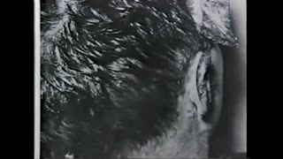 Mantik Examined Rear Autopsy Photo in Stereoscopic Viewer, Hair is 2D Matte Superimposed On Blowout