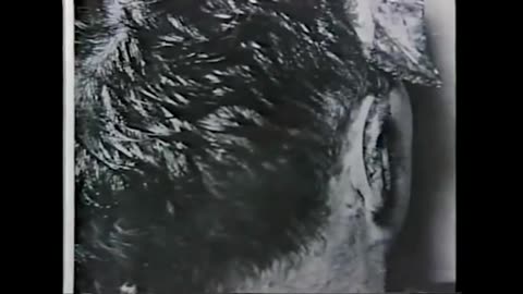 Mantik Examined Rear Autopsy Photo in Stereoscopic Viewer, Hair is 2D Matte Superimposed On Blowout