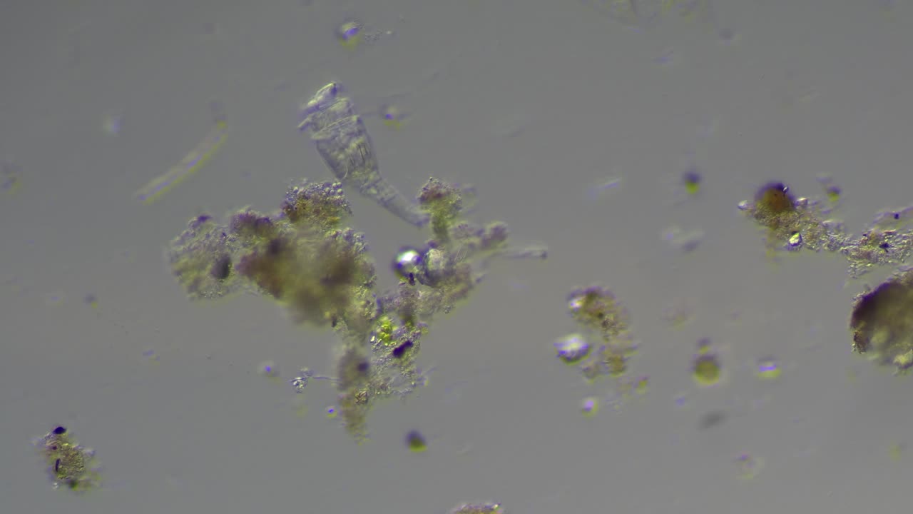 Ditch Water Under the Microscope