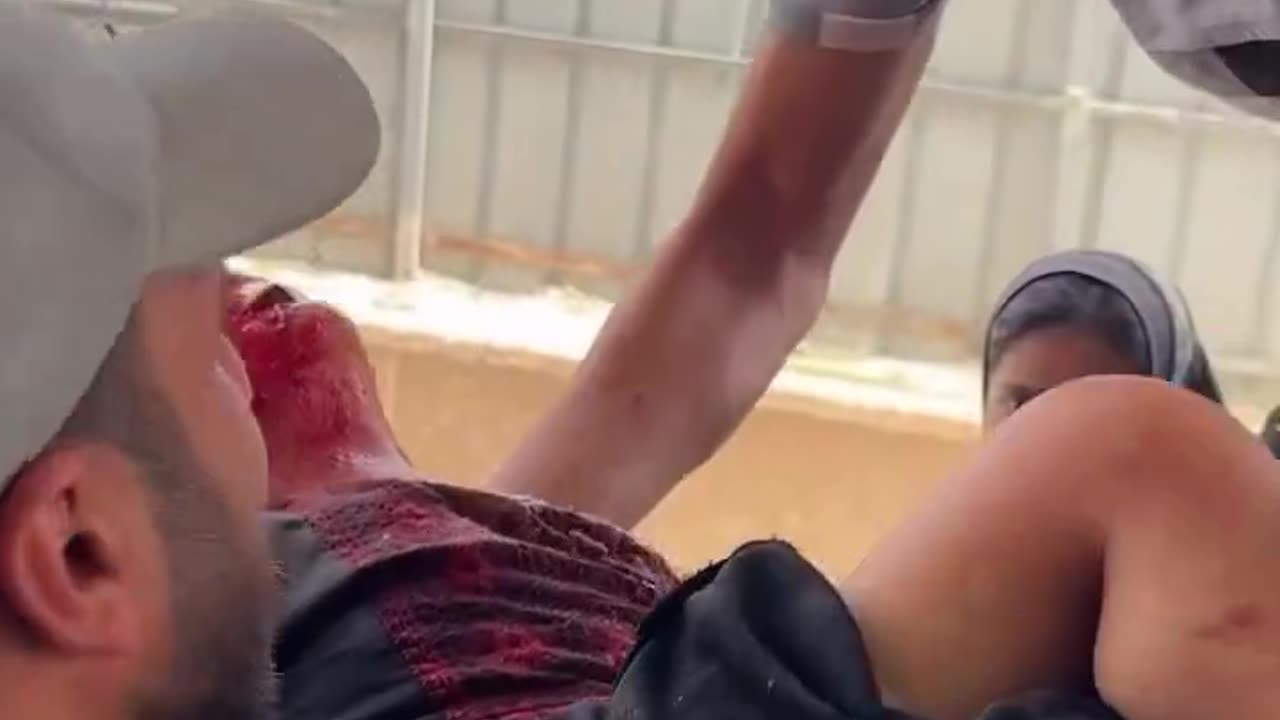 3 Palestinians were killed and 16 others were injured in an air strike