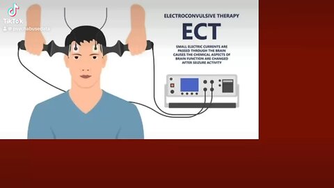Ban electroshocks- sign this petition now