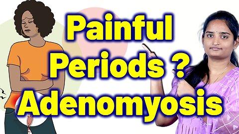 Signs & Symptoms Of Adenomyosis, Uterine Wall Endometriosis, Internal Endometriosis | Homeopathy