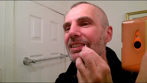 Beard pluck - hairs on the corner of the mouth