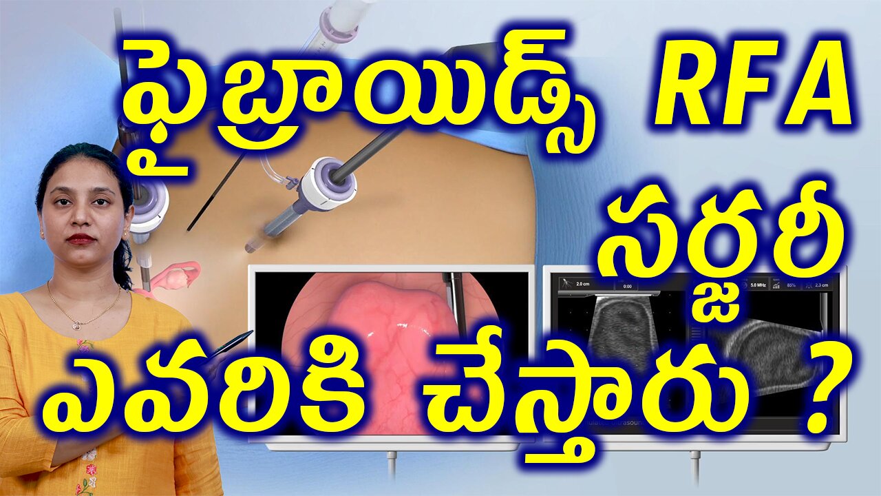 ఫైబ్రాయిడ్స్ RFA సర్జరీ ఎవరికి చేస్తారు?Fibroids Removal Surgery Radio Frequency Ablation Conditions