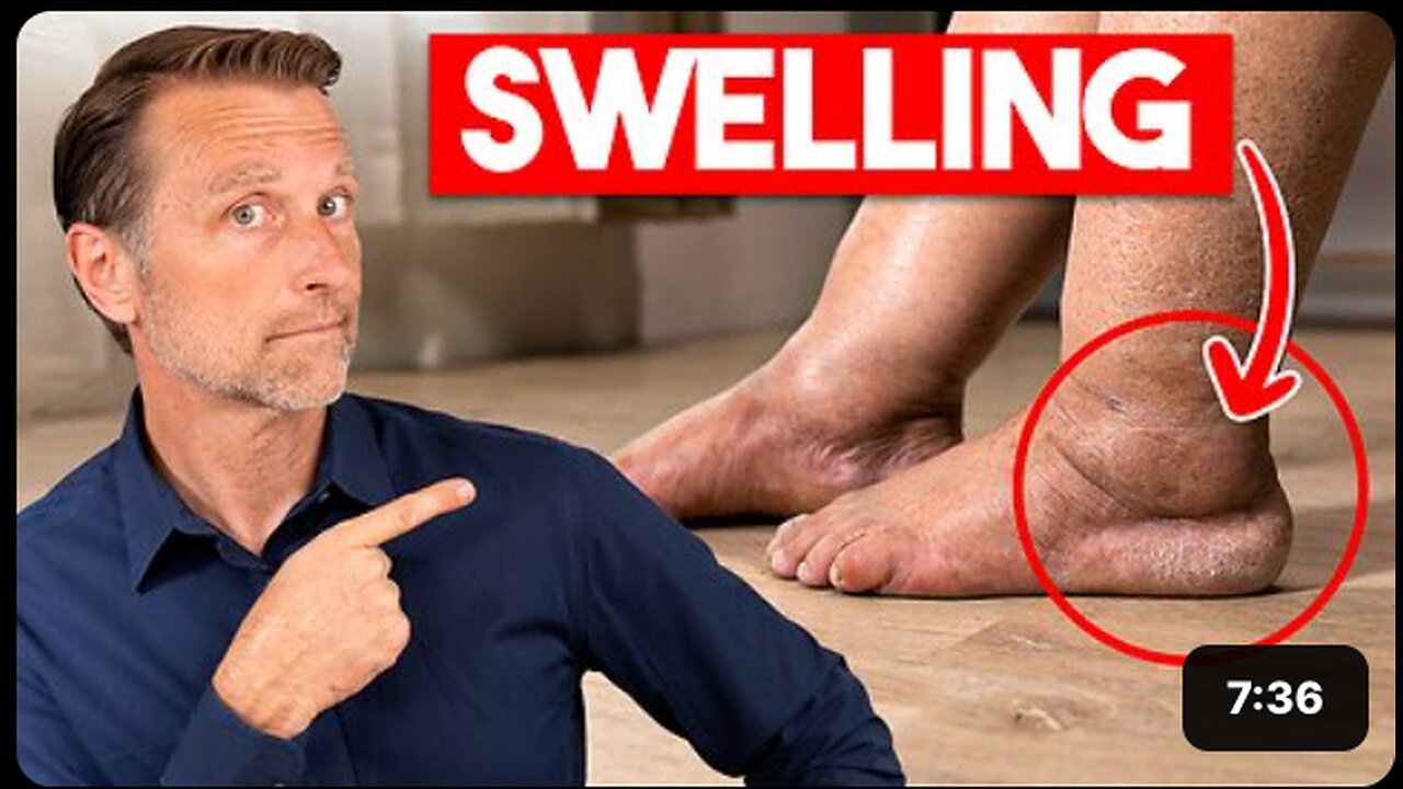 #1 Vitamin to Eliminate Swollen Legs and Ankles