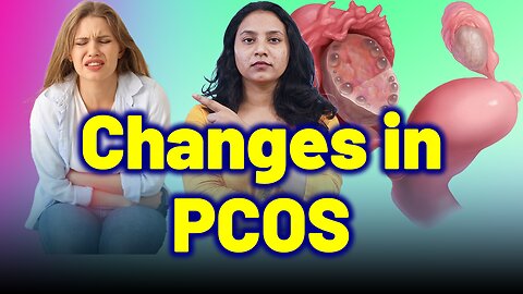 Hormonal Imbalance in PCOS: A Deeper Understanding | Treatment Cure Medicine Surgery | Gynaecology