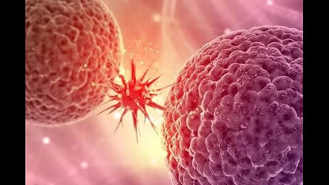 Shocking Turbo Cancer is on the rise in young people