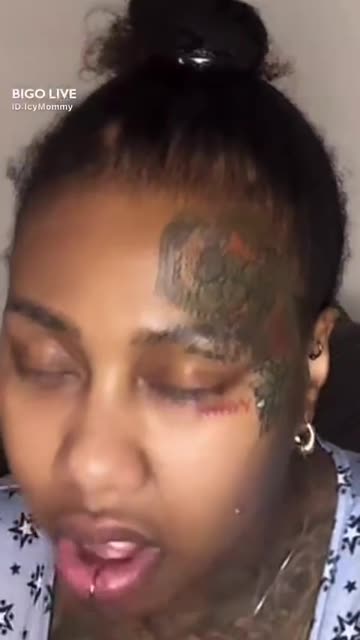 STORM GOING BALD FROM WIGS AND VINCE !!!