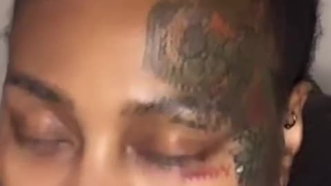 STORM GOING BALD FROM WIGS AND VINCE !!!