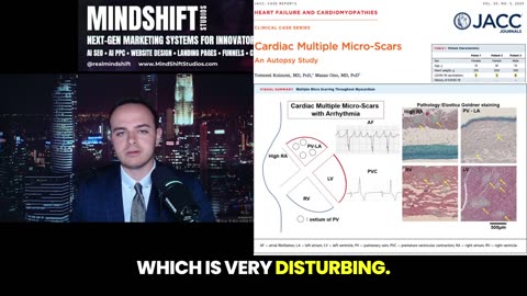 COVID-19 ⚕ VACCINE-INDUCED CARDIAC ARREST