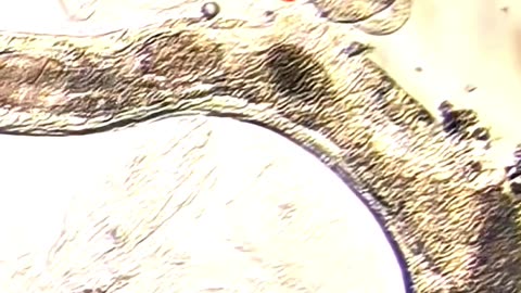 Garlic Juice vs. Parasitic Worms – You Won’t Believe This! 🍍🧬