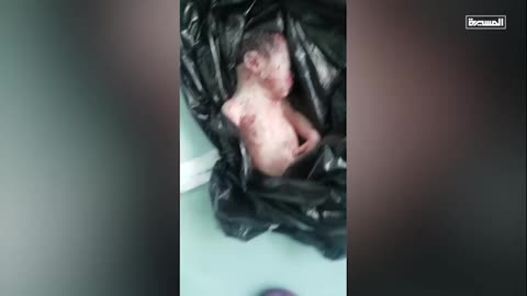 Martyrdom of a child