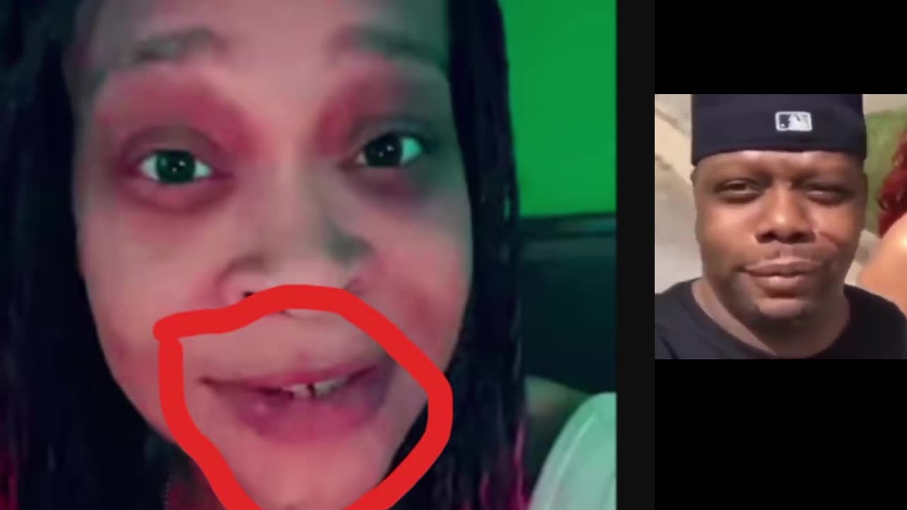MIKE MILLZ CANT GET OVER GETTING KNOCKED OUT BY L.A. DEFEND A 25$ HOOKER