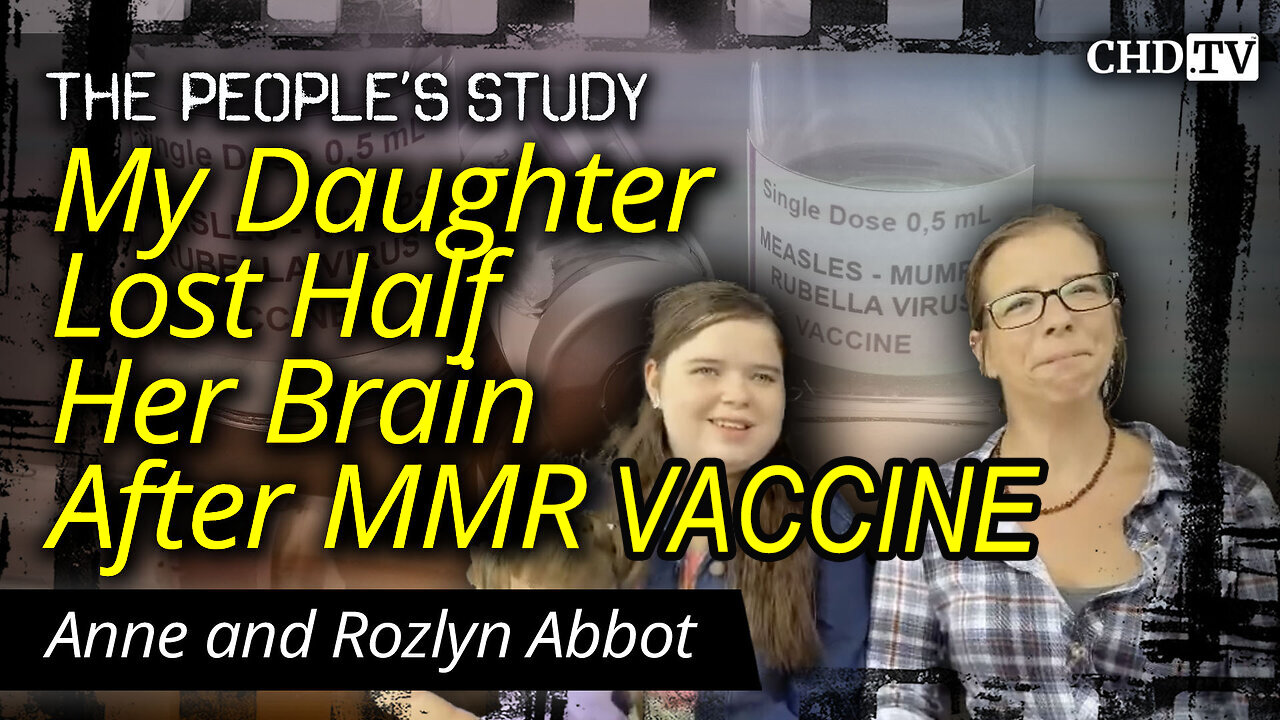 My Daughter Lost Half Her Brain After The MMR Vaccine
