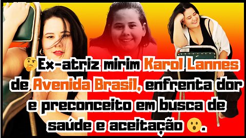 Ex-atriz mirim #KarolLannes de #avenidabrasil, enfrenta dor e preconceito em busca de melhor saúde!.
