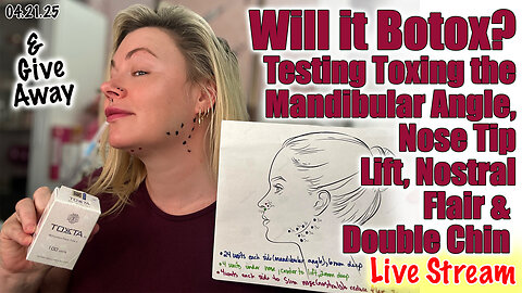 Live Will it Botox? Testing Toxing Mandibular Angle, Nose Tip, Nostril Flair & Chin, AcecOsm.com