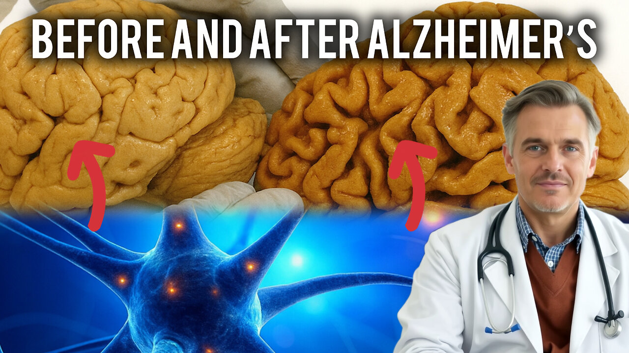 🧠Alzheimer’s: How the Brain’s ETA Changes Before and After the Disease.