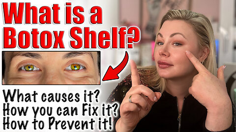 What is a Botox Shelf?? How can You Prevent it? Code Jessica10 saves you Money