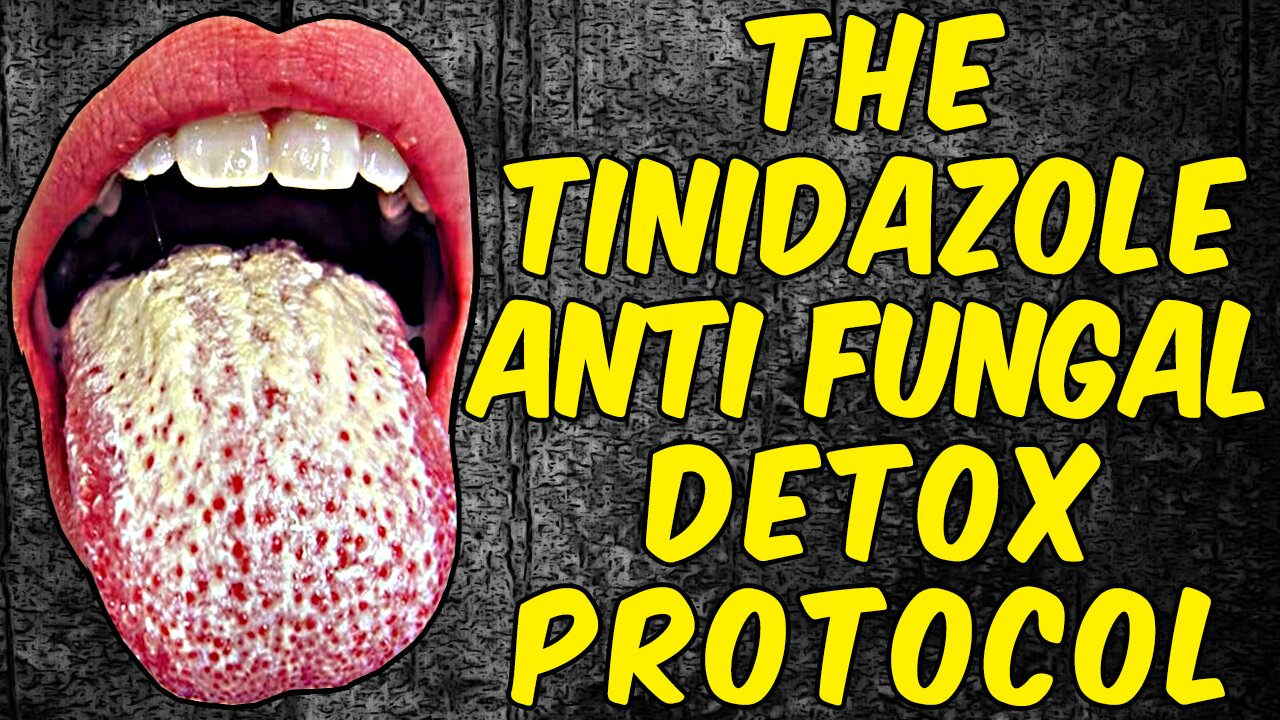 The Tinidazole Anti-Fungal Detox Protocol
