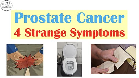 Think It’s a Gut Issue? 4 Surprising Symptoms Linked to Prostate Cancer