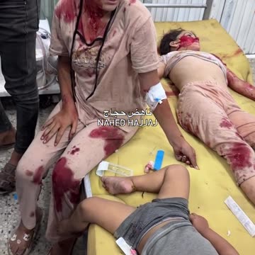 Most of the casualties were children who arrived at Al-Shifa Hospital