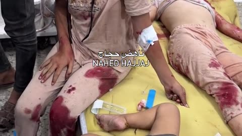 Most of the casualties were children who arrived at Al-Shifa Hospital