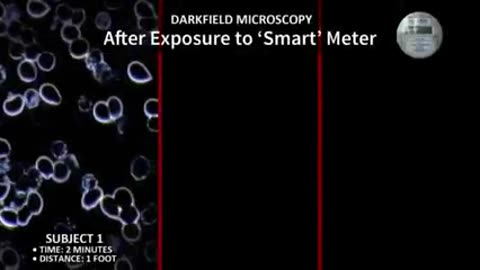 5G-SMART-METER-RADIATION-DESTROYS-BLOOD-INTEGRITY-OXYGENATION