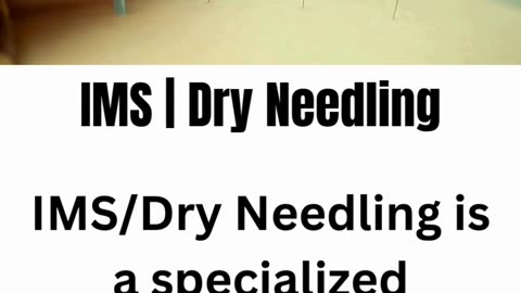 IMS / Dry Needling Therapy | Pain Relief at Divinecare Physiotherapy Langley