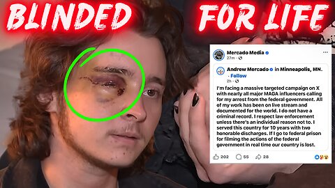 ‘I’LL NEVER SEE AGAIN’ — Anti-ICE Protester Blinded For Life | Mercado DOX Backlash