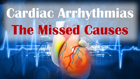 Cardiac Arrhythmias - The Missed Causes