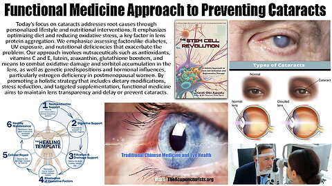 Functional Medicine Approach to Preventing Cataracts