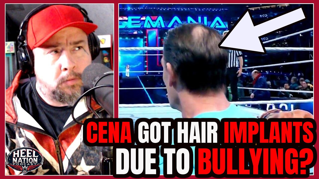John Cena Says We Bullied Him into Hair Transplant! LOL!