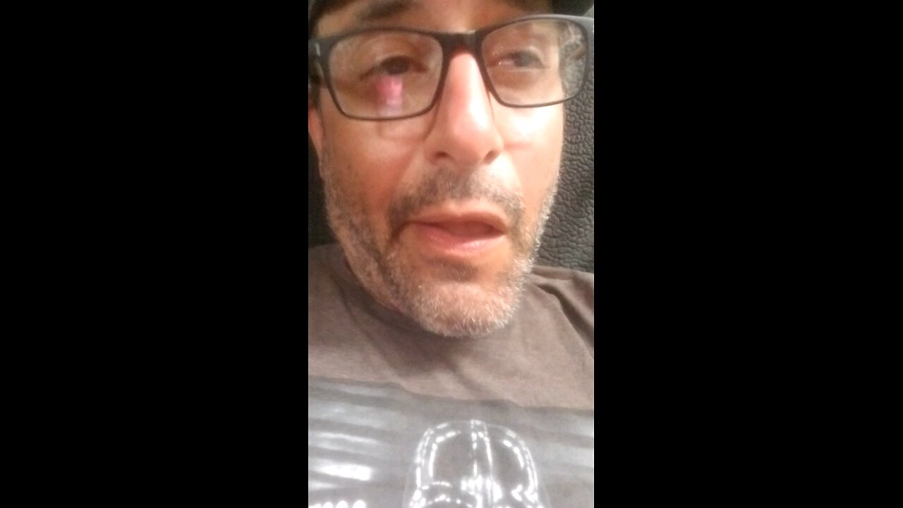 Excessive force? YOU? nooooooooo waaaaaaaay....