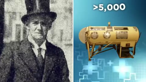 He's Been Locked In This Machine For 70 Years - Paul Alexander