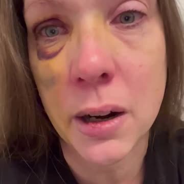 The Cincinnati woman attacked by a mob has broken her silence, revealing