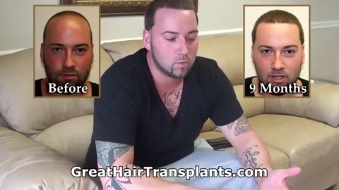 Great Hair Transplants: Young Man’s Hair Growth Journey with Dr. Brett Bolton
