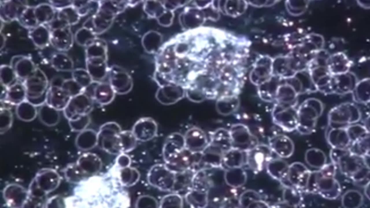 Protoplasts and Symplasts in Live Blood ANalysis