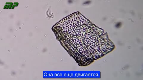 Анализ под микроскопом вакцины AstraZeneca, проведенный доктором Лилианой Селада Рюк.1